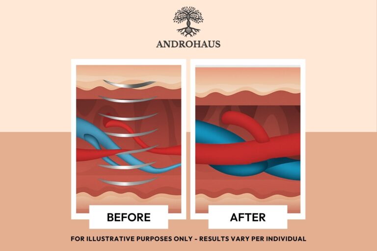 erectile dysfunction shockwave therapy