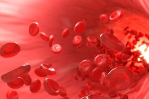 Shockwave Therapy in London